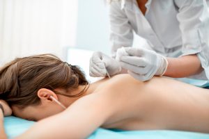 Acupuntura para Dor nas Costas: alívio, equilíbrio e bem-estar natural