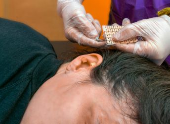 Auriculoterapia: o que é, para que serve e benefícios desta terapia integrativa