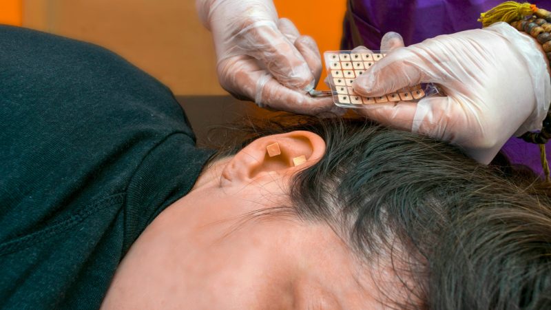 Auriculoterapia: o que é, para que serve e benefícios desta terapia integrativa