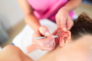 Auriculoterapia: o que é, para que serve e benefícios desta terapia integrativa